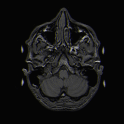 Brain MRI T1 movie.gif